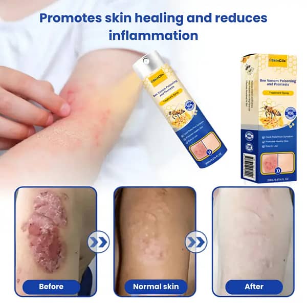 SkinClix™ | Effectively relieves itching and flaking
