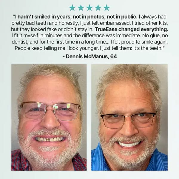 SmileCraft™ Custom-Fit Functional Dentures