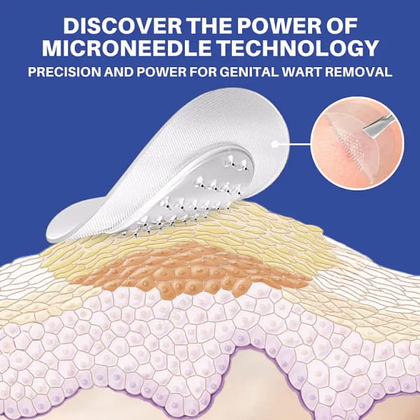 Fivfivgo® Microneedle HPV Genital Warts Removal Patch