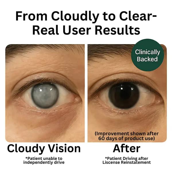 Zooone™ Advanced Eye Shield Capsules