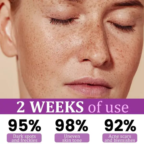 Juxek® MelantraX Advanced Anti-Hyperpigmentation Essence