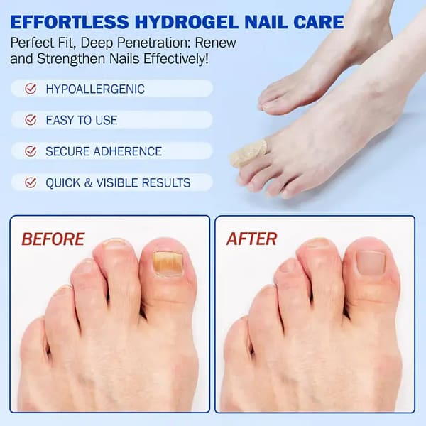 ClearNail | Combate el hongo. Fortalece tus uñas.