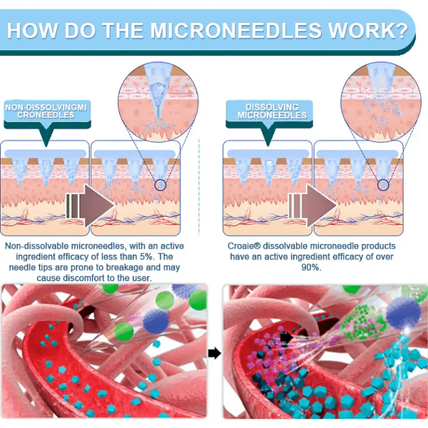 Croaie® NIDDK-Tirzepatide Nano Microneedle Patch