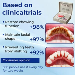 Nurbini™ Advanced Customized Full Denture Set