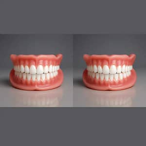 NESLEMY™ Custom-Fit Functional Dentures