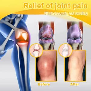 ODALIT™ Botulinum Toxin & Bee Venom Pain-Relief Bone Healing Cream