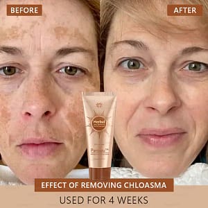 Parowu™ Whitening and Spot-Removing Face Mask Suitable