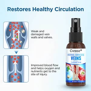 Cvreoz® Herbal Varicose Veins Treatment Spray