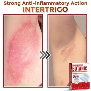 LOVILDS® MicroNeedle Botanic Skin Tag Removal Patch