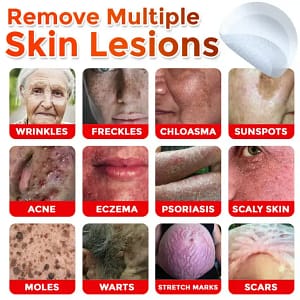 LOVILDS® MicroNeedle Botanic Skin Tag Removal Patch