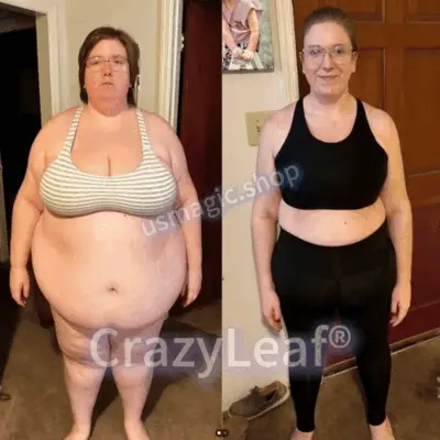 CrazyLeaf® Tirzepatide GIP/GLP-1 Dual-Action Slimming & Health Boost Drops