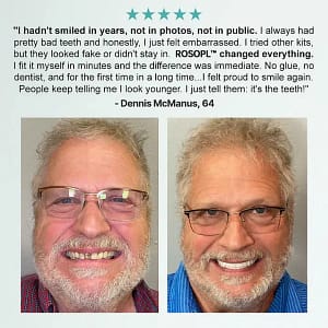 ROSOPL™ Advanced Customized Full Denture Set