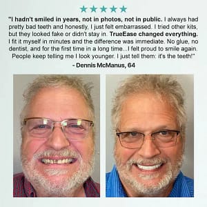 NESLEMY™ Advanced Customized Full Denture Set