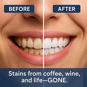 Newyuo® Nicotinamide Toothpaste New upgrade