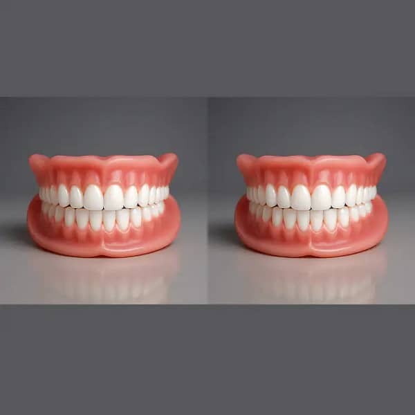 NESLEMY™ Custom-Fit Functional Dentures