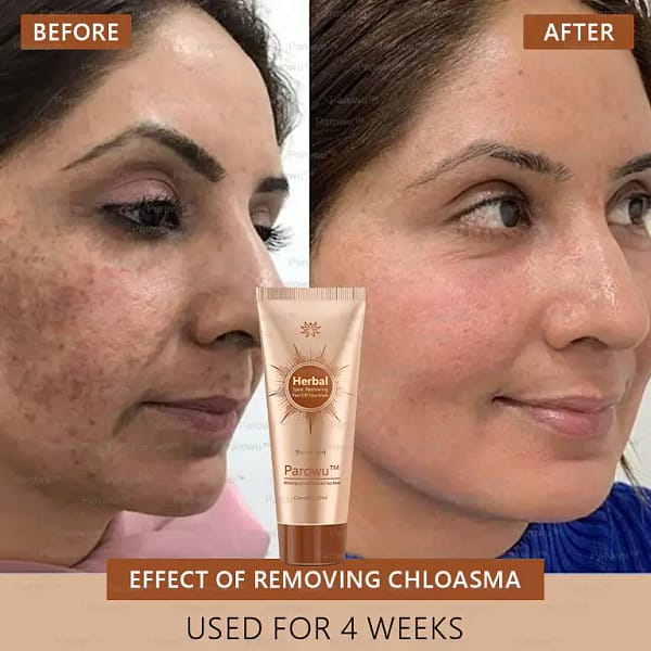 Parowu™ Whitening and Spot-Removing Face Mask Suitable