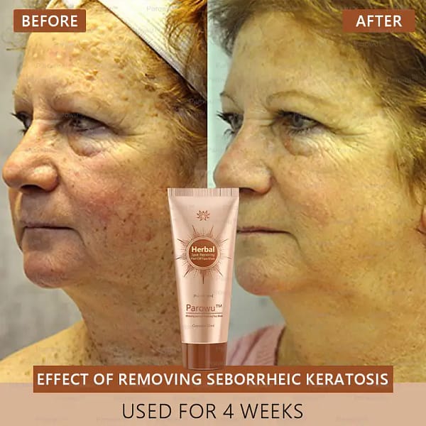 Parowu™ Whitening and Spot-Removing Face Mask Suitable