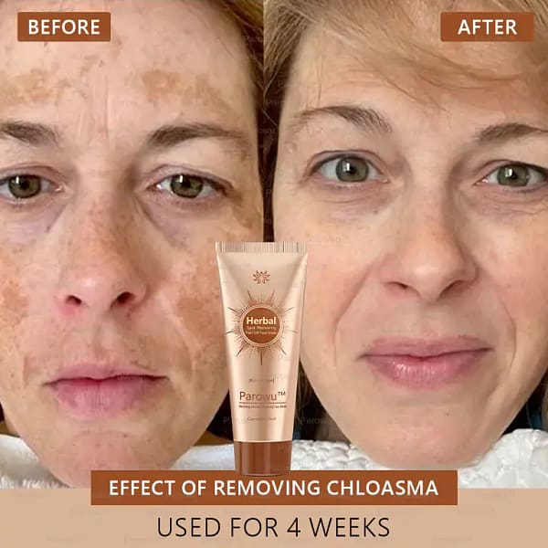 Parowu™ Whitening and Spot-Removing Face Mask Suitable