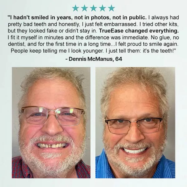 NESLEMY™ Advanced Customized Full Denture Set
