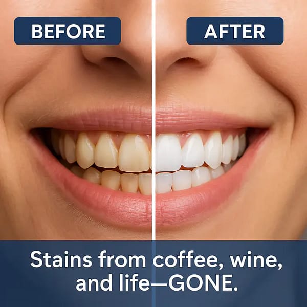 Newyuo® Nicotinamide Toothpaste New upgrade