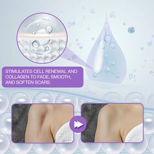 ATTDX® RevivaDerma Face & Body Scar Gel
