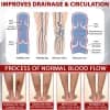 ATTDX® Advanced CVI Edema Therapy Cream