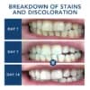 ATTDX® Laser Smile Care Device