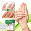 LOVILDS™Tea Tree Focused Wart Away MicroDart Patch