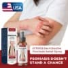 ATTDX® DermSoothe Psoriasis Relief Spray