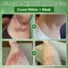 AEXZR® Tea Tree Oil Skin Treatment Cream