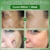 AEXZR® Tea Tree Oil Skin Treatment Cream