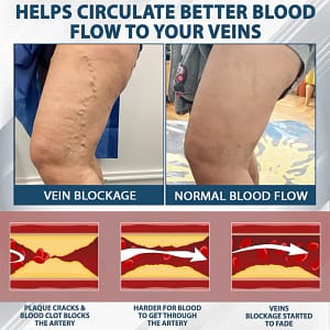 Fivfivgo® VenoHerb Black Cumin Edema Relief Balm