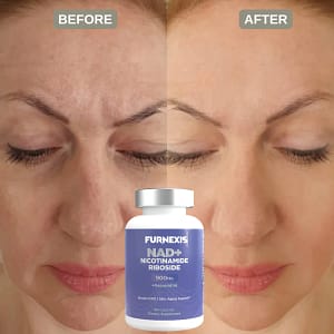 Furnexis NAD+ Nicotinamide Riboside Plus