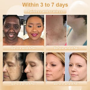 JORONDY® Bee Bright Kolirin Advanced Cream