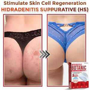 GFOUK MicroNeedle Botanic Skin Tag Removal PatchArtboard 18 7