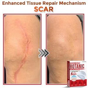 GFOUK MicroNeedle Botanic Skin Tag Removal PatchArtboard 18 9