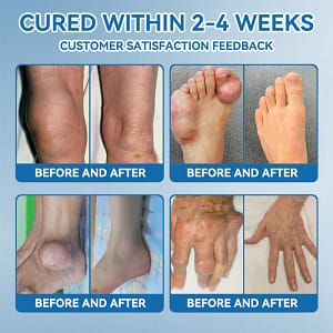 flysmus® BPC-157 Joint Healing Cream