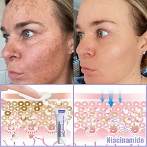 Oveallgo® Anti-Wrinkle Cream To Eliminate Wrinkles