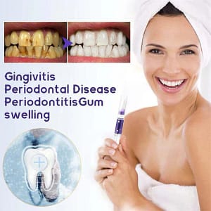 LOVILDS™ Gum Care Gel – Restore & Strengthen Your Gums