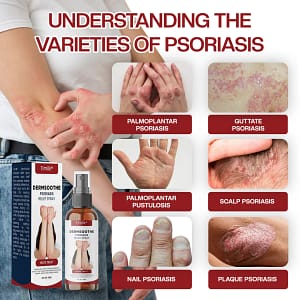Timilk® DermSoothe Psoriasis Relief Spray