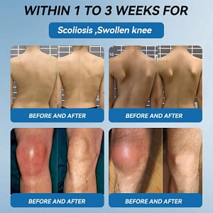 flysmus® BPC-157 Joint Healing Cream