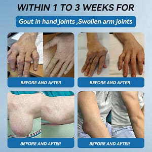 flysmus® BPC-157 Joint Healing Cream