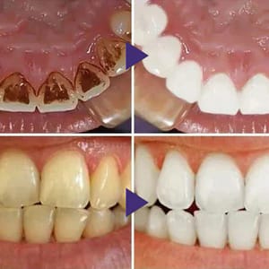 LOVILDS™ Gum Care Gel – Restore & Strengthen Your Gums