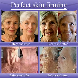 Oveallgo® Anti-Wrinkle Cream To Eliminate Wrinkles