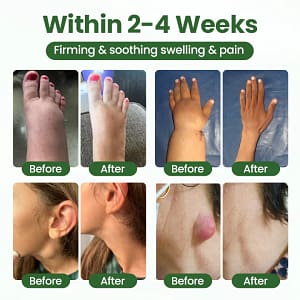 Timilk® BodyRelief Circulation Cream