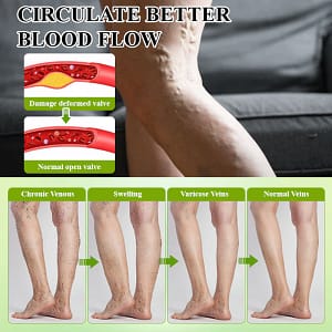 ATTDX® FluidiQ Edema Support Spray