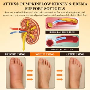 ATTDX® PumpkinFlow Kidney & Edema Support Softgels