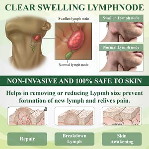 ATTDX® SwellSoothe Lymphatic Cream
