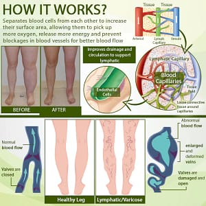ATTDX® SwellSoothe Lymphatic Cream