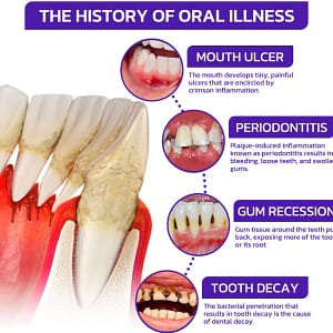 Rolimey® VioCore Bee Venom Dental Treatment Toothpaste